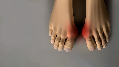 Пенсионерам скидка 10% на операции по коррекции деформации переднего отдела стопы